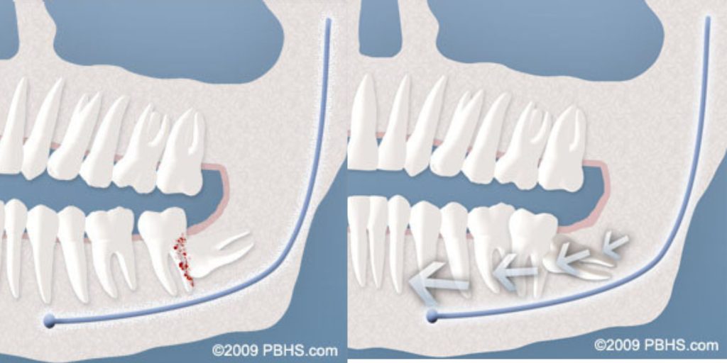 Hehr Oral Surgery